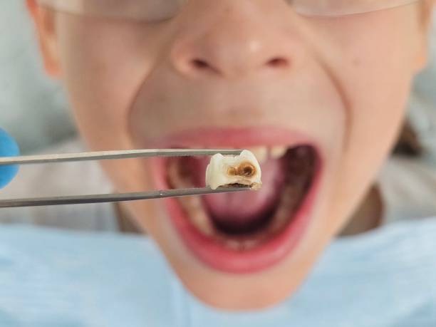 Best Emergency TMJ Treatment in Wacousta, MI